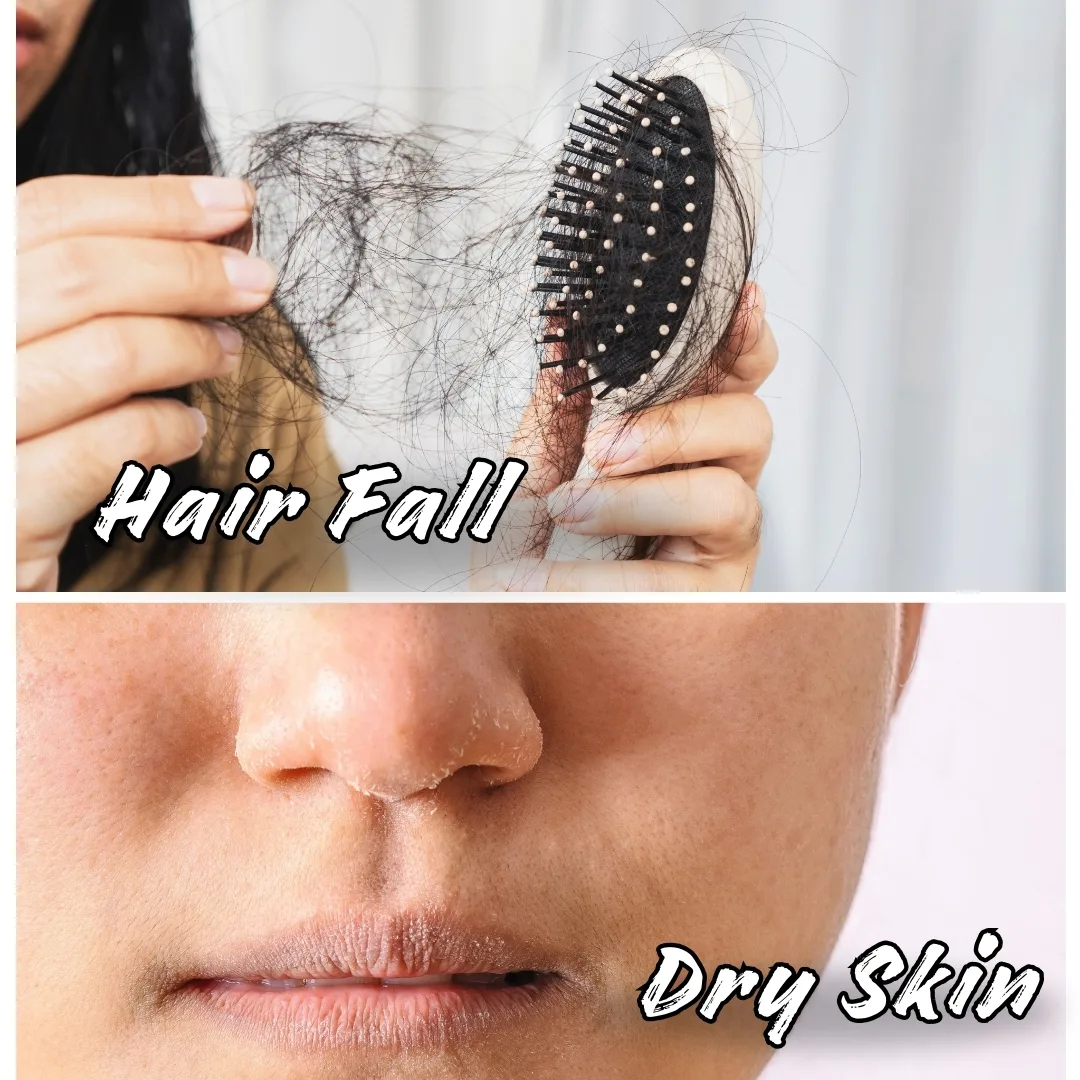 hard-water-causes-hair-fall-and-skin-dryness